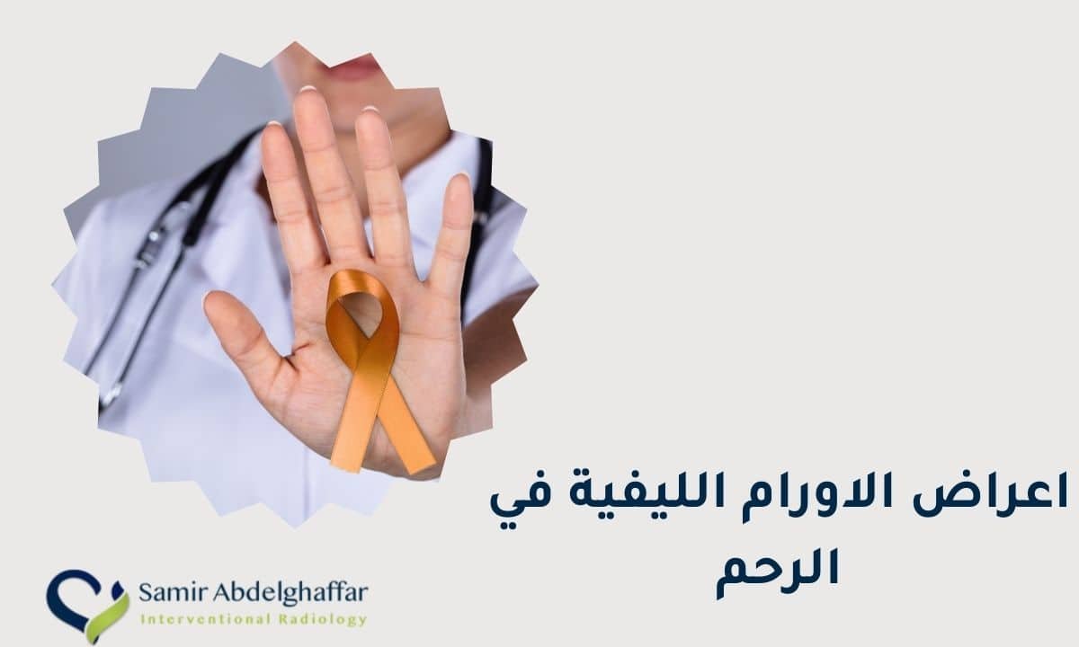 أعراض الأورام الليفية في الرحم
اعراض اورام الرحم الليفية