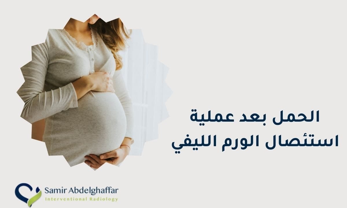 الحمل بعد عملية استئصال الورم الليفي