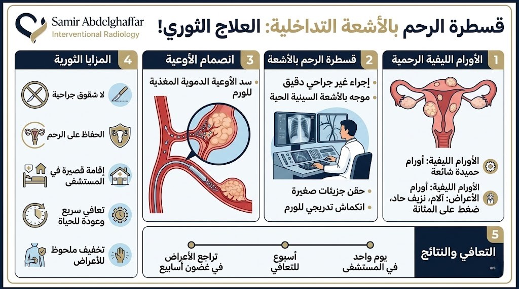 قسطرة الرحم لعلاج العضال الغدي - إجراء بدون جراحة