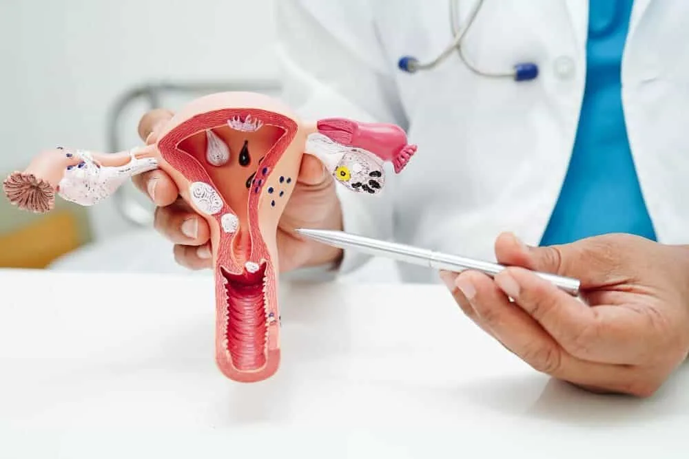 كيف شكل الكيس الدموي إذا نزل؟