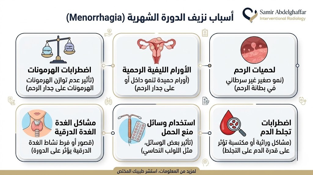 أسباب نزيف الدورة الشهرية للمتزوجة والعزباء