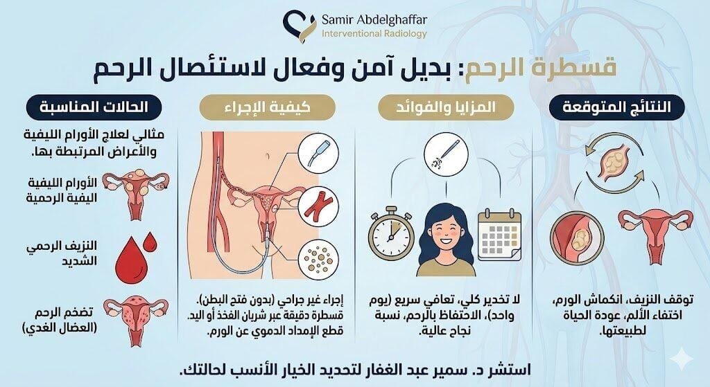 بديل استئصال الرحم ( قسطرة الرحم)