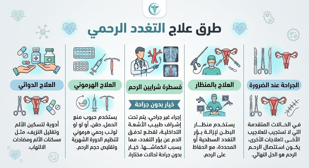 علاج التغدد الرحمي: أحدث علاج بالأشعة التداخلية 2 طرق علاج التغدد الرحمي