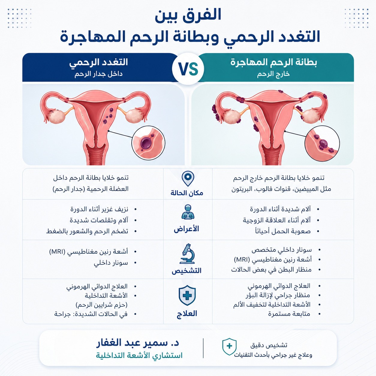 علاج التغدد الرحمي: أحدث علاج بالأشعة التداخلية 1 الفرق بين التغدد الرحمي وبطانة الرحم المهاجرة