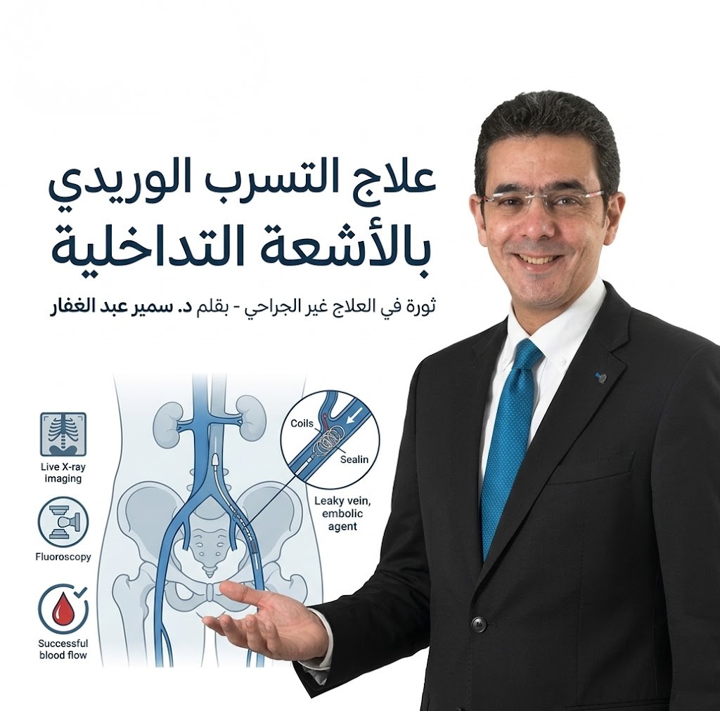 علاج التسرب الوريدي بالاشعة التداخلية