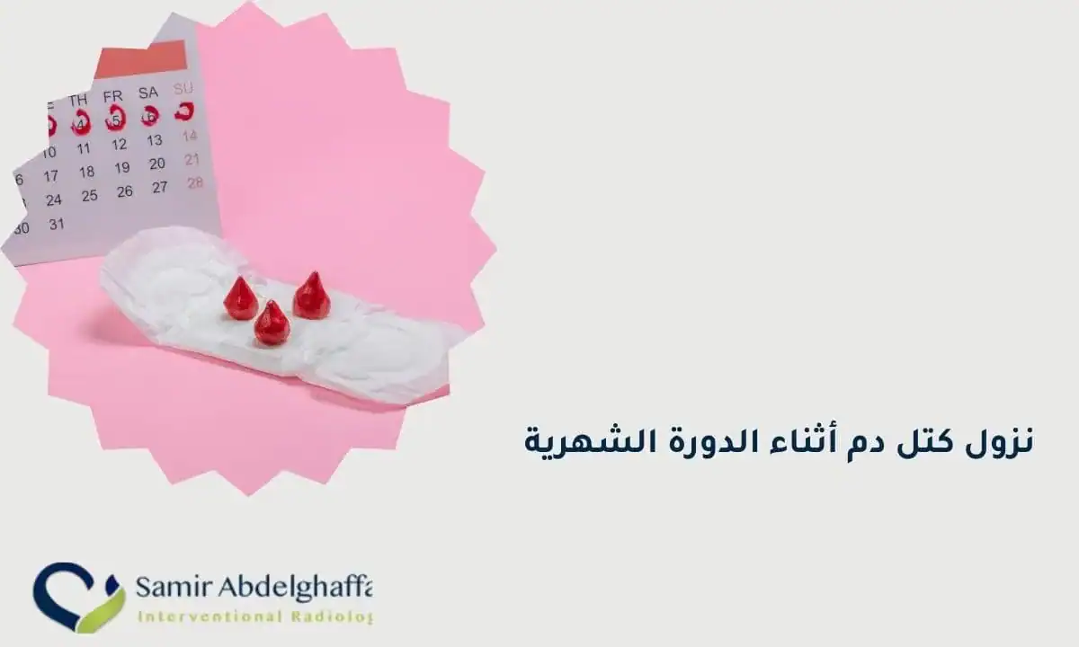 نزول كتل دم أثناء الدورة الشهرية للمتزوجة: الأسباب والحلول