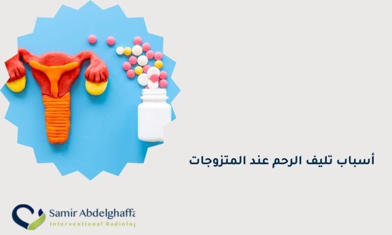 أسباب تليف الرحم عند المتزوجات