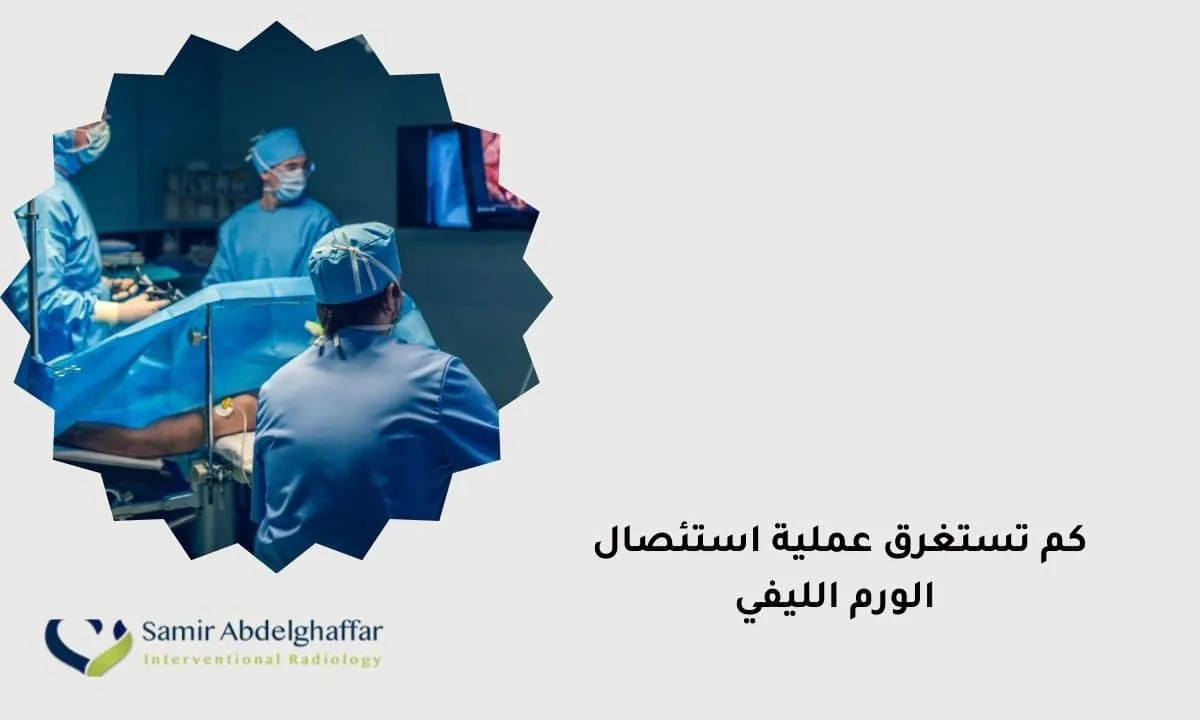 كم تستغرق عملية استئصال الورم الليفي؟