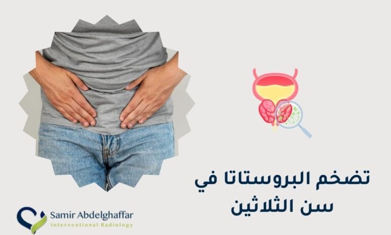 تضخم البروستاتا في سن الثلاثين