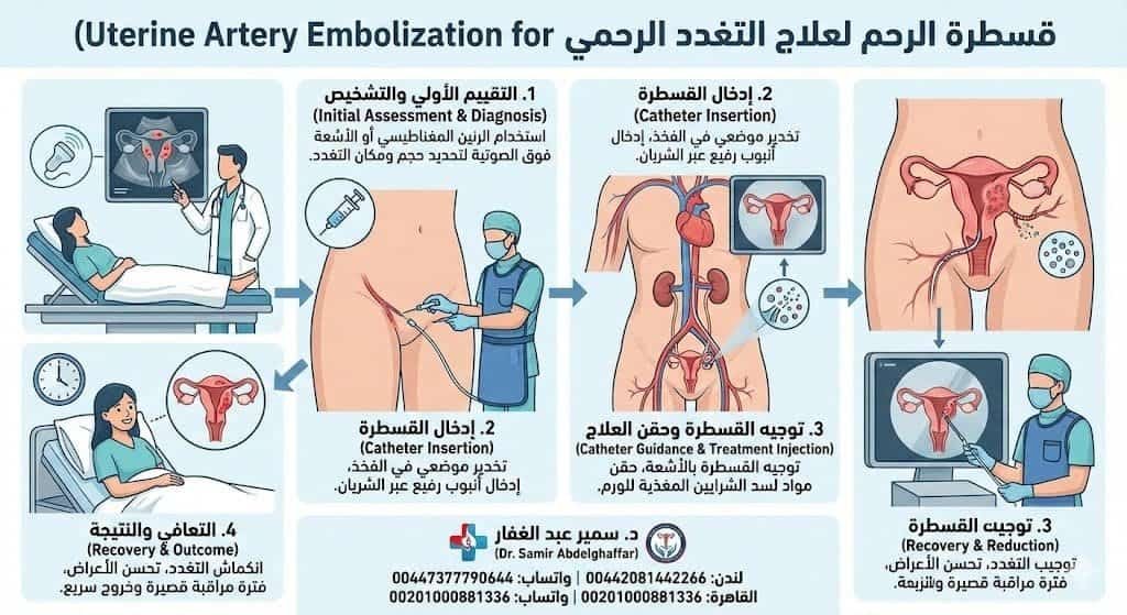 علاج التغدد الرحمي