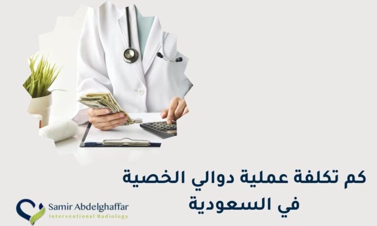 كم تكلفة عملية دوالي الخصية في السعودية