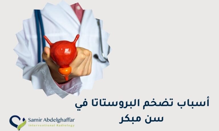 أسباب تضخم البروستاتا في سن مبكر