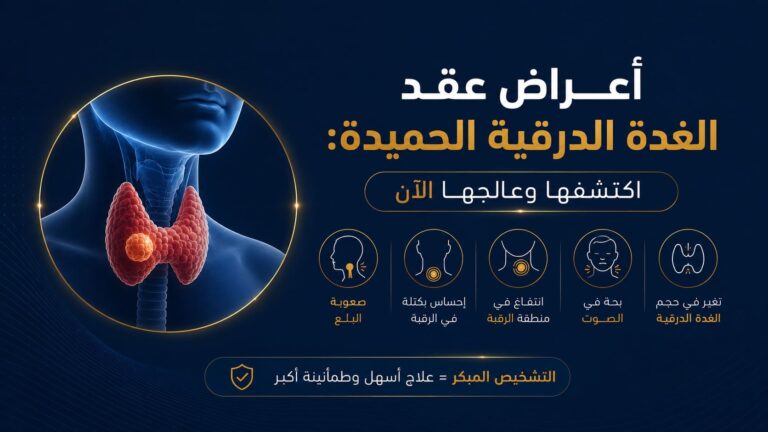أعراض عقد الغدة الدرقية الحميدة