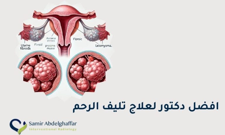 أفضل دكتور لعلاج تليف الرحم