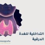 الاشعة التداخلية للغدة الدرقية