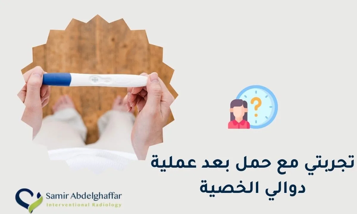تجربتي مع حمل بعد عملية دوالي الخصية