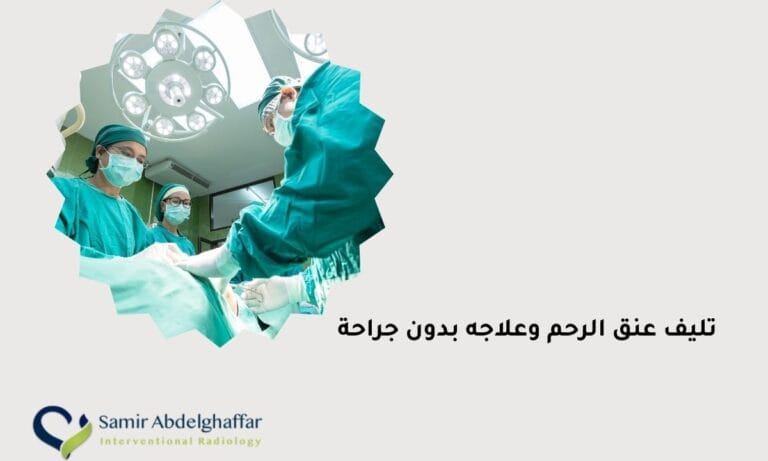 تليف عنق الرحم وعلاجه بدون جراحة