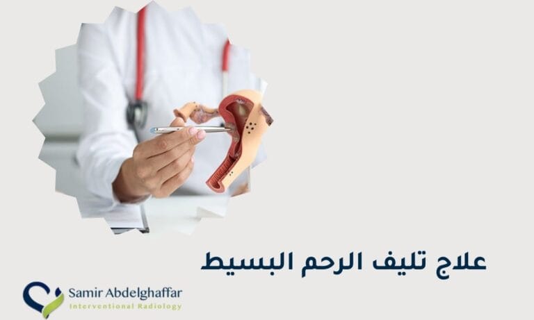 علاج تليف الرحم البسيط