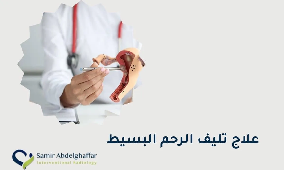 علاج تليف الرحم البسيط 1 علاج تليف الرحم البسيط